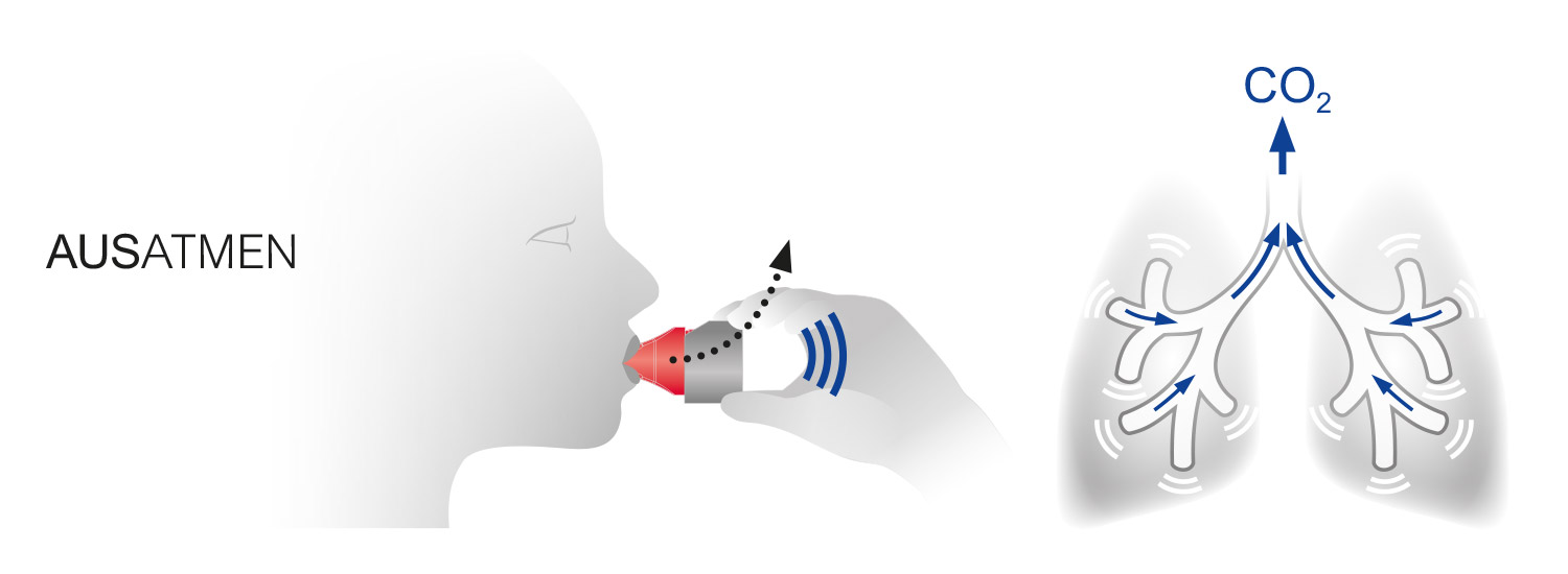 rc fit opep kurzanleitung infografik
