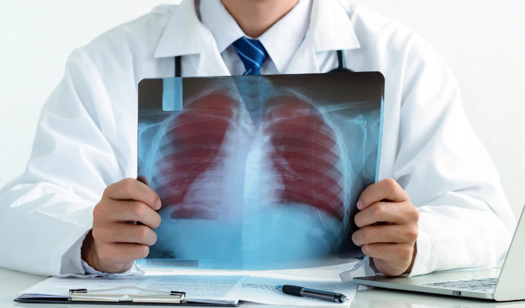 Ein Arzt zeigt einem Patienten ein Röntgenbild der Lungen.