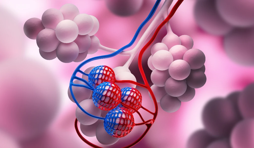 Zentrilobuläres (zentroazinäres) Lungenemphysem