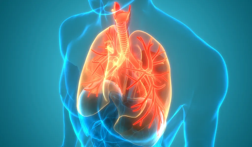 Asthma bronchiale – Definition